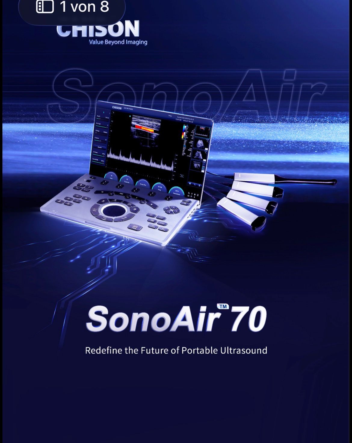 جهاز الموجات فوق الصوتية المحمول CHISON SonoAir 70