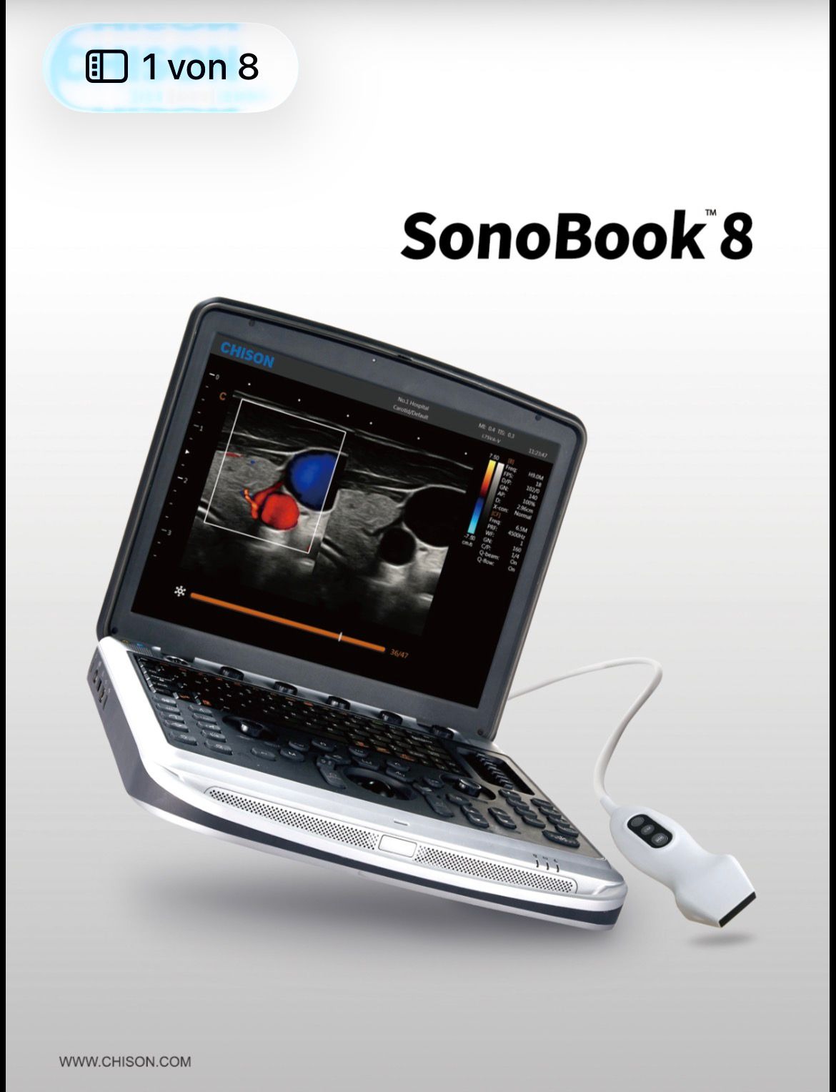 جهاز الموجات فوق الصوتية المحمول CHISON SonoBook 8