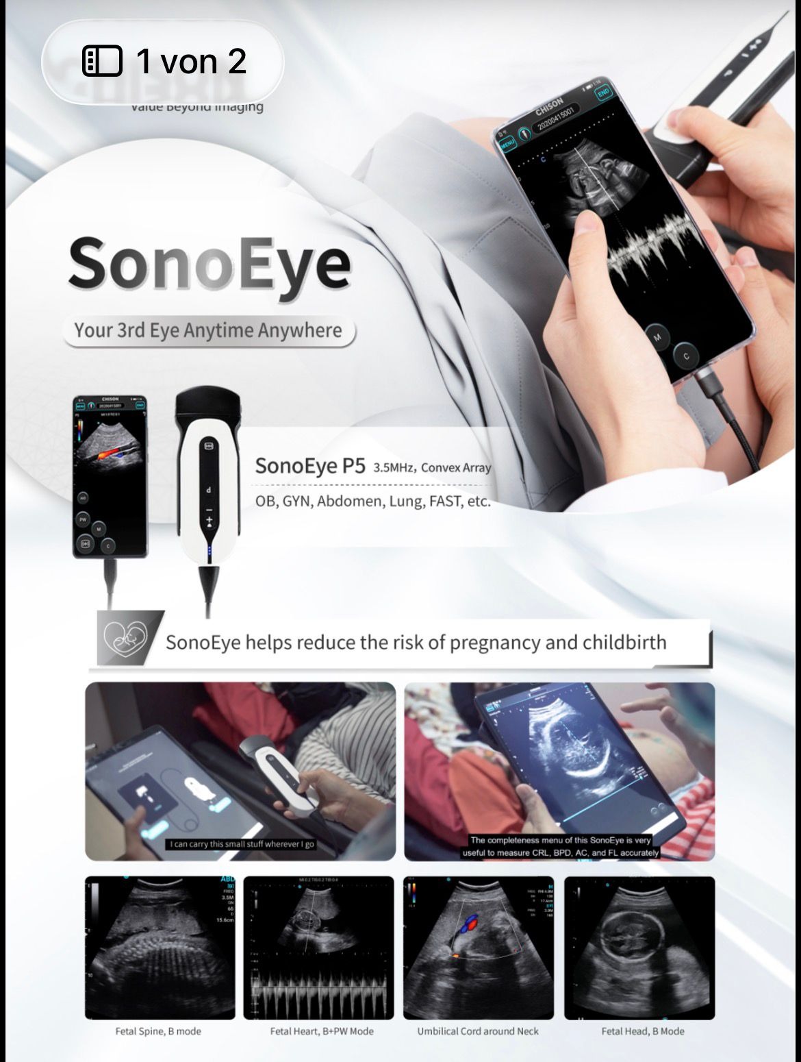 جهاز الموجات فوق الصوتية اللاسلكي CHISON SonoEye P5