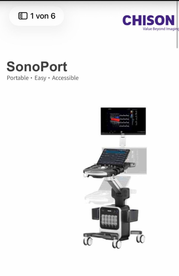 جهاز الموجات فوق الصوتية CHISON SonoPort